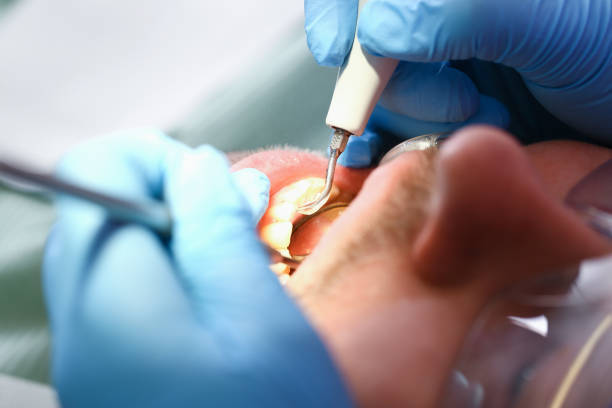 Best Emergency TMJ Treatment in Salado, TX